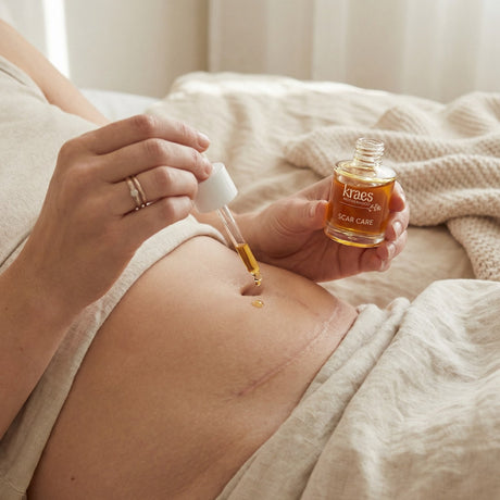 Kraes Scar Care